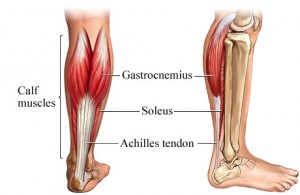 Achilles Tendonitis