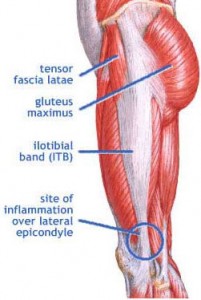 How to Treat Injuries - IT Band