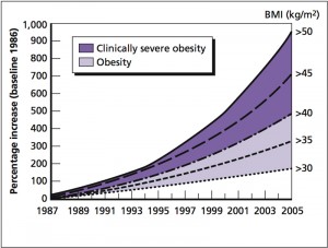 US Obesity